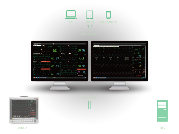 EDAN V-Series - Image 3