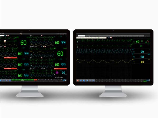 EDAN MFM-CNS Maternal/Foetal Monitoring Central Nursing Station - Image 2