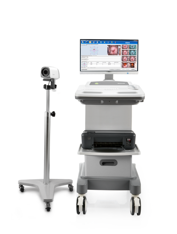 EDAN C3/C6 Video Colposcope